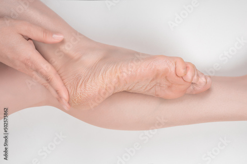 Closeup beautiful young woman applying cream and lotion foot dry on white background  moisturizer and treatment cosmetic onto toes and heel  skincare cosmetic and healthy concept.