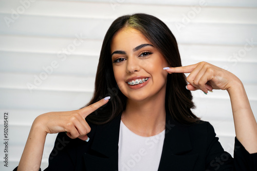 Fototapeta Naklejka Na Ścianę i Meble -  Cute young adult girl pointing with fingers to her dental braces, studio shot 