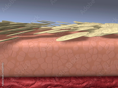 Dry skin flaking off from the epidermis. Epidermal squamous cells, older skin cells, eventually dry and flake off photo
