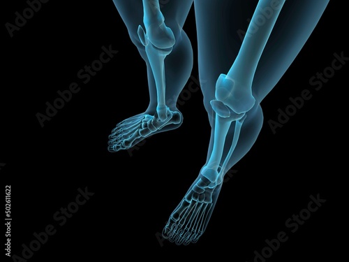 X-ray view of knees