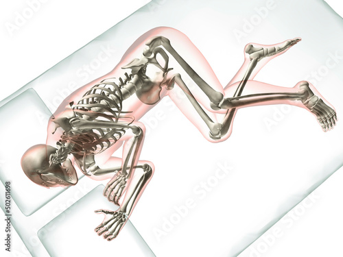 X-ray view of a man sleeping photo
