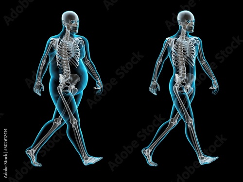 X-ray skeletons of obese and thin men walking photo