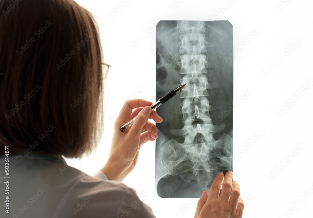 Female doctor holds and examines spinal column scan against background ...