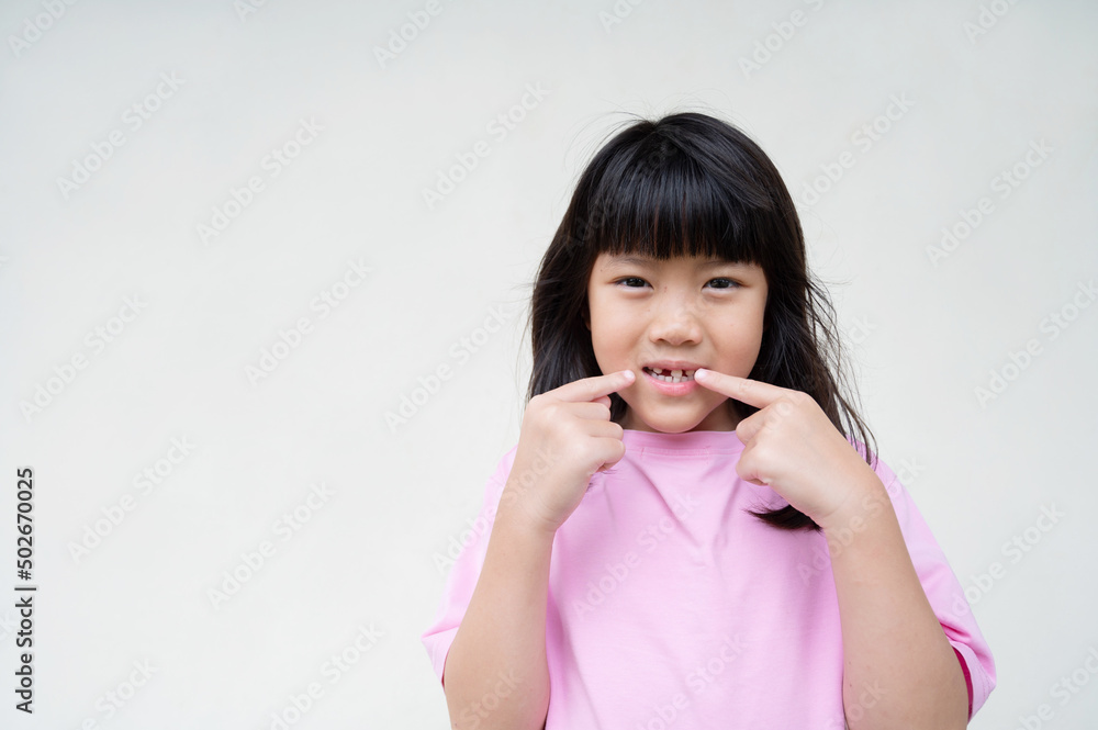 kid broken tooth, asian girl smiling