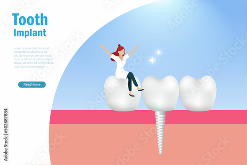 Dental tooth implant, stomatology, oral medicine care concept. Dentist doctor  with tooth implant on gum. Dental treatment and oral healthcare concept.