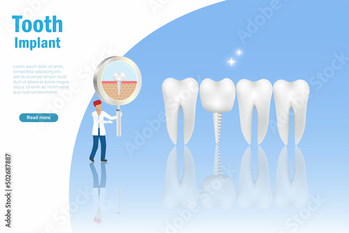 Dental tooth implant, stomatology, oral medicine care concept. Dentist doctor hold magnifying glass with tooth implant on gum. Dental treatment and oral healthcare concept.