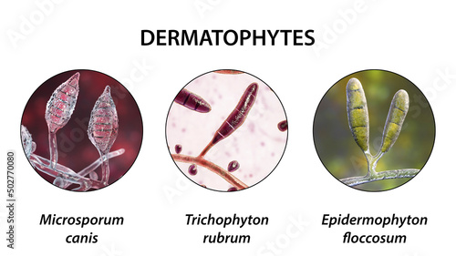 Dermatophyte fungi, 3D illustration photo