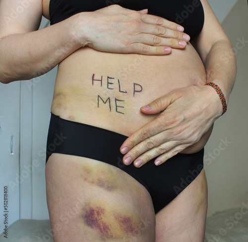 Domestic violence concept: the body of a pregnant woman with bruises