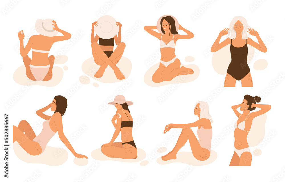 Women with stretch marks set. Tanning girls in swimsuits  in different poses. Skin treatment. Body positivity, self love aesthetic collection. Isolated vector illustration in cartoon style