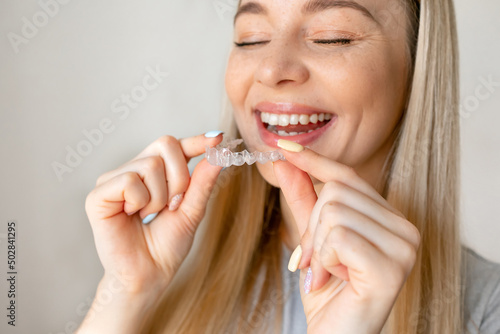 Portrait of beautiful patient holding orthodontic retainers in dental clinic