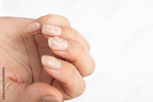 Liquid for home removal of gel nail polish in action on a woman s hand