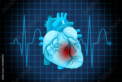 Human heart disease symbol