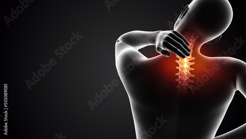 Human having pain in neck 