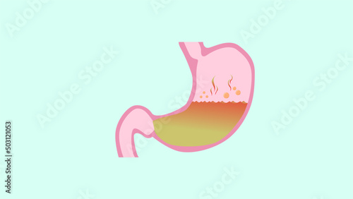 illustration of a Gerd stomach vector