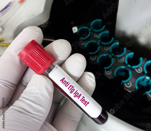 Blood Sample for Anti tTg(Tissue transglutaminase) IgA test, diagnosis of celiac disease. photo