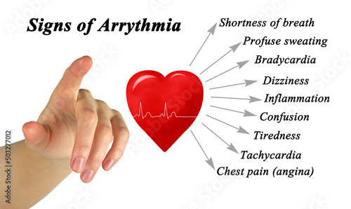 Presenting Nine Sign of Arrythmia