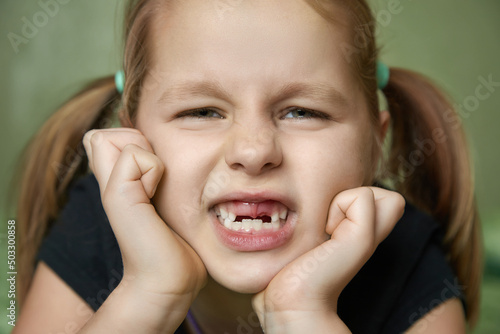portrait of a girl with bad teeth, her front upper teeth fell out