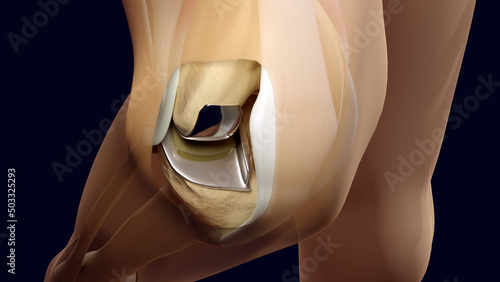 Prosthetic knee joint with semi-transparent skin  photo