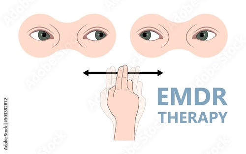 Talk therapy Eye and reprocessing post trauma treat EMDR brain panic attacks emotion EFT tapping hypnosis experiences