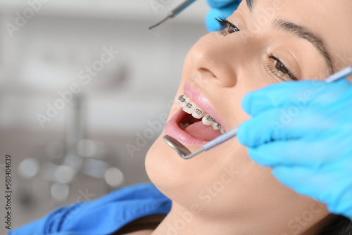 Beautiful woman with dental braces visiting dentist in clinic  closeup