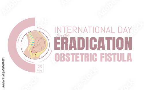 International Day for the eradication of obstetric fistula.diagram of where the fistula can form.flat vector illustration