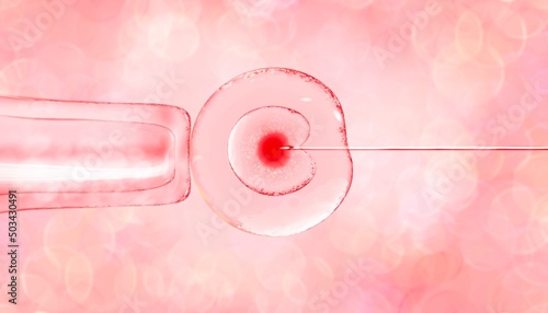 3d illustration of in vitro fertilization under a microscope. egg, medical needle, test tube, pipette. Beautiful medical banner in pink tones with a blurred background with highlights and texture photo