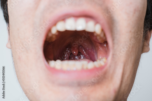 mouth