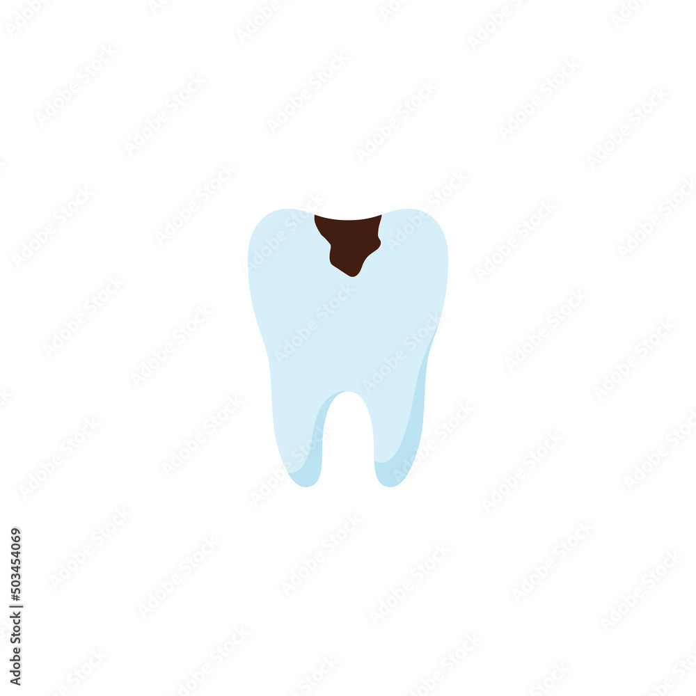 Tooth with caries, stomatological help or treatment concepts, flat vector illustration isolated on white background. Tooth with caries, stomatological help or treatment concepts, flat vector illustration isolated on white background.