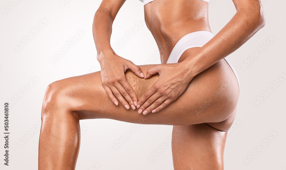 Woman making heart sign gesture on thigh with cellulite Woman making heart sign gesture on thigh with cellulite