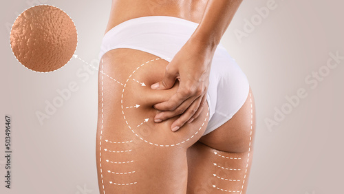 Unrecognizable young woman pinching her buttocks, examining cellulite photo
