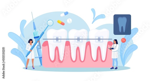 Orthodontist installs dental braces for straightening. Tiny Dentist doctor research X-ray picture of tooth. Dentistry, braces installation, teeth alignment. Prosthetics, Orthodontic treatment. Vector 