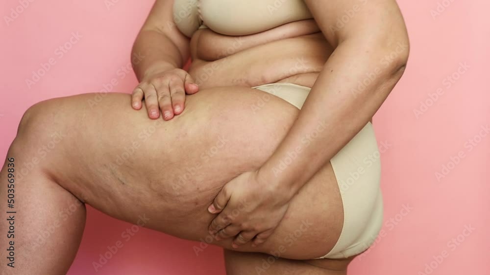 Unrecognizable fat and adipose woman after childbirth, compressing the skin of the buttocks, sides and hips. Checking cellulite and excess subcutaneous fat. Emphasizing excess overweight. Side view Unrecognizable fat and adipose woman after childbirth, compressing the skin of the buttocks, sides and hips. Checking cellulite and excess subcutaneous fat. Emphasizing excess overweight. Side view