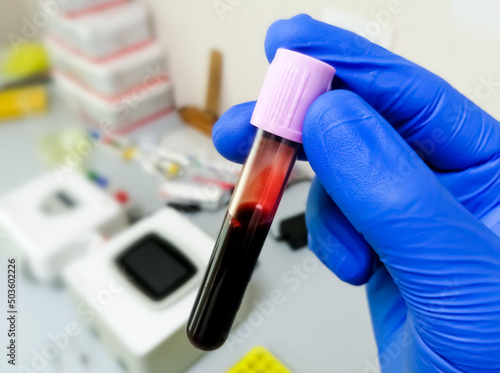 Scientist or techinician hold levender tube with blood sample for hematological or whole blood test.