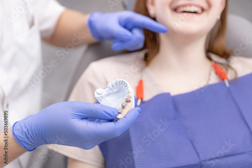 Cast jaw of young woman for implantation tooth implant  dentist holds plaster model