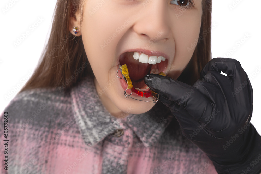 A doctor in black medical gloves tries on an orthodontic appliance for a little girl. The concept of teeth alignment in childhood. Studio photo on a white background. A doctor in black medical gloves tries on an orthodontic appliance for a little girl. The concept of teeth alignment in childhood. Studio photo on a white background.