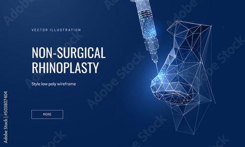 Nose filler injection concept of non-surgical rhinoplasty. Vector illustration of a nose with a syringe in a futuristic polygonal style. Infographics of changing the shape of the nose