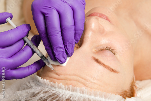 A cosmetologist performs a procedure of rejuvenating injections for the face to tighten and smooth out wrinkles on the skin of a woman's face. Cosmetic skin care in a beauty salon.