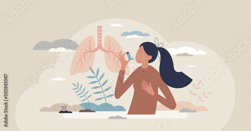Asthma chronic disease with medical breathing problems tiny person concept. Allergic pollen symptoms with bronchial chest pain and spray for normal airways vector illustration. Respiration health care
