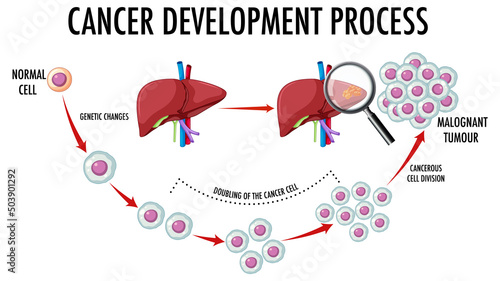 Diagram showing cancer development process