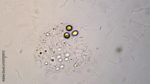 microorganisms in a drop of water from a freshwater lake