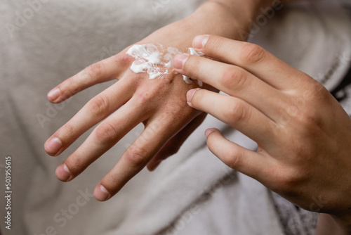 Dry hands with wounds. Dry hands with wounds. Hand cream. White background.