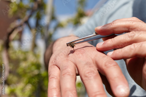 treatment with bees photo