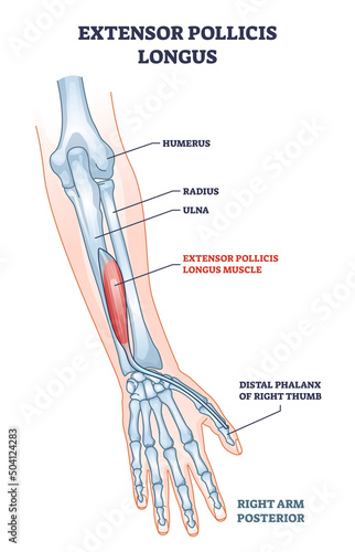 Fototapeta Extensor pollicis longus muscle location with arm skeleton outline diagram