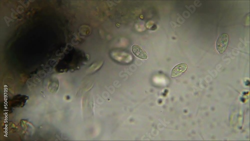 Micro organisms ciliates moving in dirty water, microscope magnification 40X photo