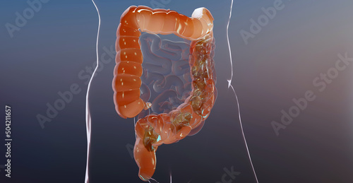 3d illustration of human digestive system anatomy, concept of the intestine, laxative, traitement of constipation, 3d render	 photo