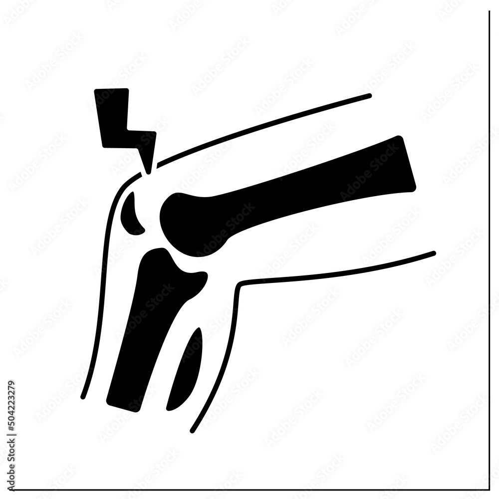 Stress fracture glyph icon. Fatigueinduced bone fracture caused by
