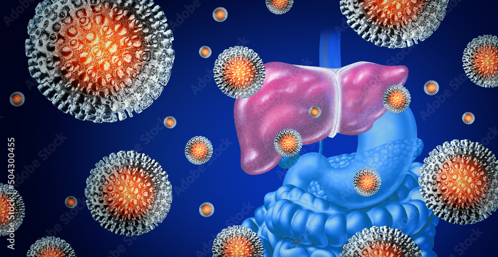 Hepatitis disease concept as a group of three dimensional human virus cells on a human liver as a medical illustration for a viral infection  - obrazy, fototapety, plakaty 