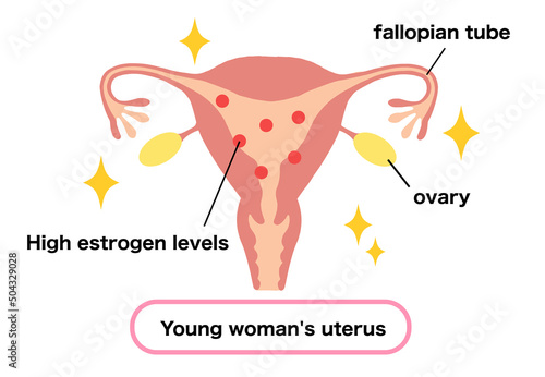 Illustration of a young woman's uterus with high estrogen levels.