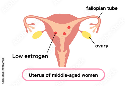 Illustration of a young woman's uterus with high estrogen levels.