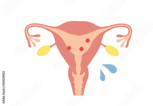 Illustration of a young woman's uterus with high estrogen levels.